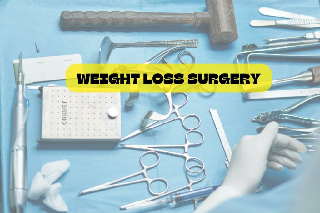 WEIGHT LOSS SURGERY